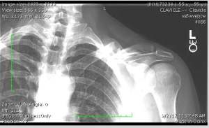 Hmmm. What would it help to remove to make you a lighter cyclist or runner? 