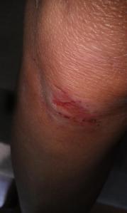 Even the smallest injury could see you mined for organs. 