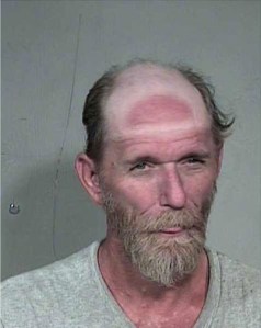 No, this is not me. This is a Hathead fail on several levels. The sunburn yes. But the rest of his head should be shaved too. Then, no hathead, hairwise. 