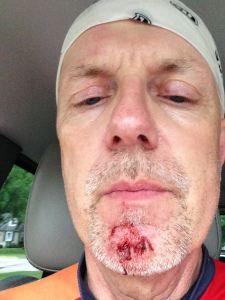 Even with contact lenses I need to remember to look where I'm going. Last summer's collision with a tree was the result of riding with my head down. Even contacts can't help you then. 