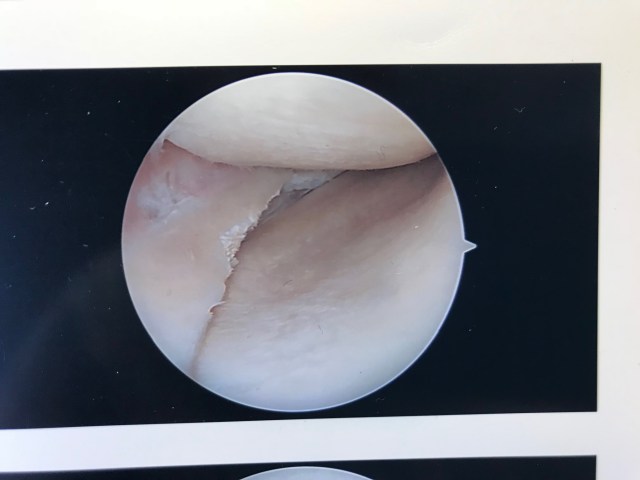 KNee porn repaired.jpg